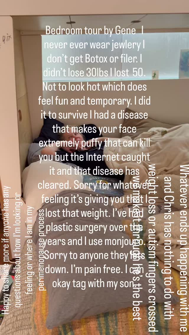Amy Schumer Addresses Marriage Speculation After Being Spotted With No Ring